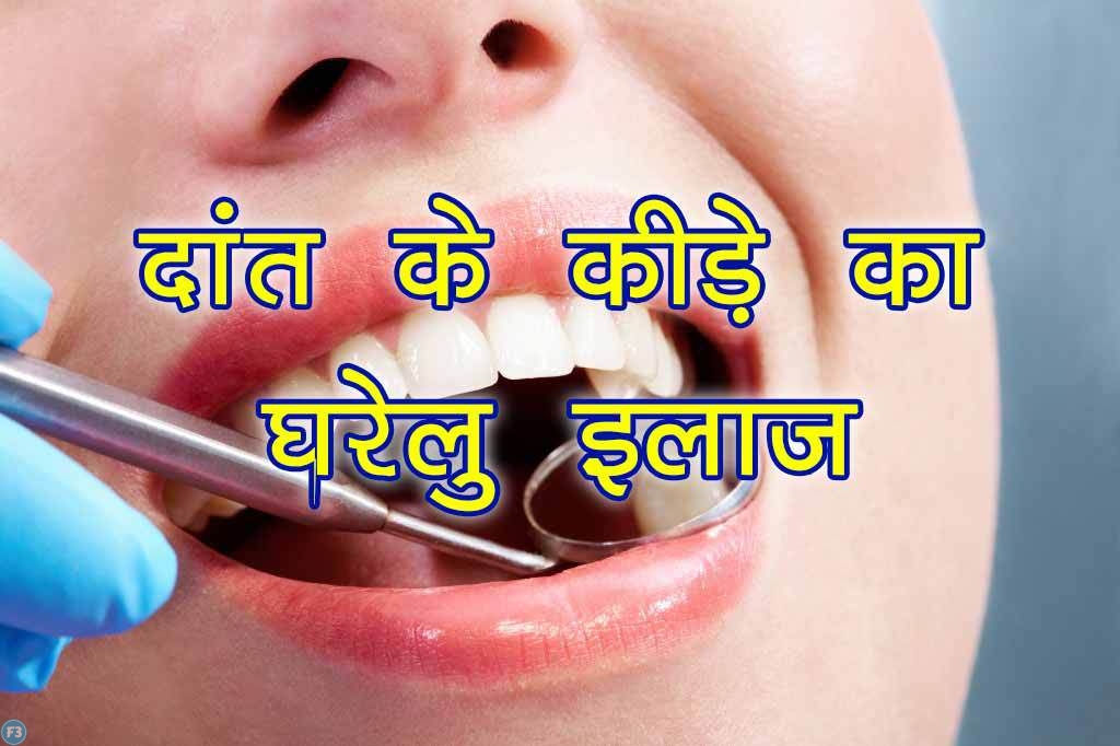 Toothache Relief 